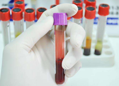 PD-1单抗特瑞普利单抗联合阿昔替尼可治疗黏膜黑色素瘤!